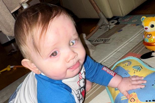 Cumbria mum and dad noticed issue in baby’s eyes – now he could lose sight
