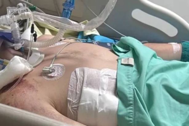 Brit fighting for life in Thailand after ‘truck runs over his head’